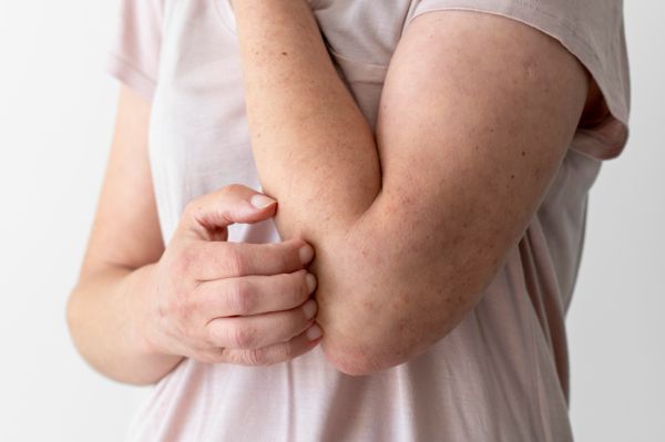 Productos para Pieles Sensibles - Dermocosmética Sa Farmacia